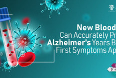 Inovasi Medis: Tes Darah Ungkap Perubahan Otak Terkait Alzheimer
