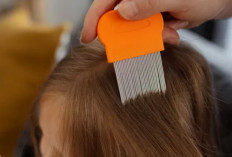 ﻿Gatal dan Tak Nyaman Karena Rambut Kutuan, Berikut Cara Ampuh Basmi Kutu Rambut 